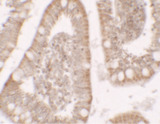 RC3H1 / ROQUIN Antibody - Immunohistochemistry of RC3H1 in human small intestine tissue with RC3H1 antibody at 5 ug/ml.