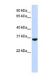 RCAN1 / DSCR1 Antibody - RCAN1 antibody Western blot of Fetal Muscle lysate. This image was taken for the unconjugated form of this product. Other forms have not been tested.