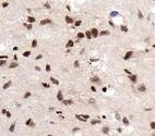 RCAN1 / DSCR1 Antibody - RCAN1 Antibody - IHC of RCAN1 in human fetal brain.  This image was taken for the unconjugated form of this product. Other forms have not been tested.
