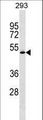 RCBTB1 Antibody - RCBTB1 Antibody western blot of 293 cell line lysates (35 ug/lane). The RCBTB1 antibody detected the RCBTB1 protein (arrow).