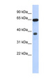 RCC2 Antibody - RCC2 antibody Western blot of 293T cell lysate. This image was taken for the unconjugated form of this product. Other forms have not been tested.