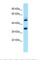 RCD1 / RQCD1 Antibody - Western blot of Human 721_B. RQCD1 antibody dilution 1.0 ug/ml.  This image was taken for the unconjugated form of this product. Other forms have not been tested.