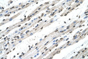 RCE1 Antibody - RCE1 antibody ARP44797_T100-NP_005124-RCE1(RCE1 homolog, prenyl protein peptidase (S. cerevisiae)) Antibody IHC of formalin-fixed, paraffin-embedded human Muscle. Positive label: Skeletal muscle cells indicated with arrows. Antibody concentration 4-8 ug/ml. Magnification 400X.  This image was taken for the unconjugated form of this product. Other forms have not been tested.