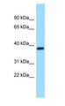 RCN3 Antibody - RCN3 antibody Western Blot of Fetal Brain.  This image was taken for the unconjugated form of this product. Other forms have not been tested.