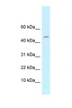 RCS / ARPP-21 Antibody - ARPP21 / ARPP-21 antibody Western blot of Mouse Spleen lysate. Antibody concentration 1 ug/ml.  This image was taken for the unconjugated form of this product. Other forms have not been tested.