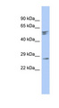 RD3 Antibody - RD3 antibody Western blot of Fetal Brain lysate. This image was taken for the unconjugated form of this product. Other forms have not been tested.