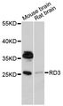 RD3 Antibody - Western blot analysis of extracts of various cell lines, using RD3 antibody at 1:1000 dilution. The secondary antibody used was an HRP Goat Anti-Rabbit IgG (H+L) at 1:10000 dilution. Lysates were loaded 25ug per lane and 3% nonfat dry milk in TBST was used for blocking. An ECL Kit was used for detection and the exposure time was 90s.