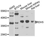 RDH1 / RDH5 Antibody - Western blot analysis of extracts of various cells.