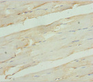 RDH12 / LCA3 Antibody - Immunohistochemistry of paraffin-embedded human skeletal muscle tissue at dilution 1:100