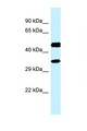 RDH13 Antibody - RDH13 antibody Western blot of Fetal Kidney lysate. Antibody concentration 1 ug/ml.  This image was taken for the unconjugated form of this product. Other forms have not been tested.