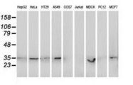 RDH14 Antibody - Western blot of extracts (35 ug) from 9 different cell lines by using anti-RDH14 monoclonal antibody.