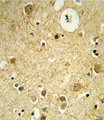 RECK Antibody - Formalin-fixed and paraffin-embedded human brain tissue reacted with RECK Antibody , which was peroxidase-conjugated to the secondary antibody, followed by DAB staining. This data demonstrates the use of this antibody for immunohistochemistry; clinical relevance has not been evaluated.
