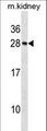 Recoverin Antibody - Mouse Rcvrn Antibody western blot of mouse kidney tissue lysates (35 ug/lane). The Rcvrn antibody detected the Rcvrn protein (arrow).