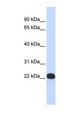 Recoverin Antibody - RCVRN / Recoverin antibody Western blot of Placenta lysate. This image was taken for the unconjugated form of this product. Other forms have not been tested.
