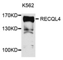 RECQL4 Antibody - Western blot analysis of extracts of K562 cells.