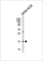 REG3A Antibody - Western blot of lysate from RPMI-8226 cell line, using REG3A Antibody. Antibody was diluted at 1:1000 at each lane. A goat anti-rabbit IgG H&L (HRP) at 1:5000 dilution was used as the secondary antibody. Lysate at 35ug per lane.