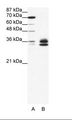 RELA / NFKB p65 Antibody - A: Marker, B: HepG2 Cell Lysate.  This image was taken for the unconjugated form of this product. Other forms have not been tested.
