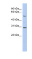 RELB Antibody - RELB antibody Western blot of THP-1 cell lysate. This image was taken for the unconjugated form of this product. Other forms have not been tested.