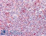 RELB Antibody - Anti-RELB antibody IHC of human spleen. Immunohistochemistry of formalin-fixed, paraffin-embedded tissue after heat-induced antigen retrieval. Antibody concentration 5 ug/ml.  This image was taken for the unconjugated form of this product. Other forms have not been tested.