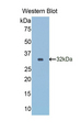 RELN / Reelin Antibody - Western blot of recombinant RELN / Reelin.