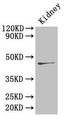 Ren2 / Renin-2 Antibody - Western Blot Positive WB detected in: Mouse kidney All lanes: Ren2 antibody at 4µg/ml Secondary Goat polyclonal to rabbit IgG at 1/50000 dilution Predicted band size: 44 kDa Observed band size: 44 kDa