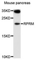 REPRIMO / RPRM Antibody - Western blot analysis of extracts of mouse pancreas, using RPRM antibody at 1:1000 dilution. The secondary antibody used was an HRP Goat Anti-Rabbit IgG (H+L) at 1:10000 dilution. Lysates were loaded 25ug per lane and 3% nonfat dry milk in TBST was used for blocking. An ECL Kit was used for detection and the exposure time was 30s.