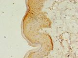 RERG Antibody - Immunohistochemistry of paraffin-embedded human skin tissue using antibody at 1:100 dilution.  This image was taken for the unconjugated form of this product. Other forms have not been tested.