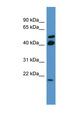 RERG Antibody - RERG antibody Western blot of COLO205 cell lysate.  This image was taken for the unconjugated form of this product. Other forms have not been tested.