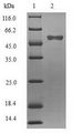Matrix Protein VP40 Protein - (Tris-Glycine gel) Discontinuous SDS-PAGE (reduced) with 5% enrichment gel and 15% separation gel.