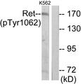 RET Antibody - Western blot analysis of lysates from K562 cells, using Ret (Phospho-Tyr1062) Antibody. The lane on the right is blocked with the phospho peptide.