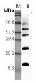 Retnla / RELM Alpha Antibody - Western blot analysis using anti-RELM-alpha (rat), pAb at 1:5000 dilution. 1: Rat RELM-alpha.  This image was taken for the unconjugated form of this product. Other forms have not been tested.