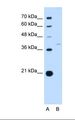 RFC3 Antibody - Lane A: Marker. Lane B: HepG2 cell lysate. Antibody concentration: 1.0 ug/ml. Gel concentration: 12%.  This image was taken for the unconjugated form of this product. Other forms have not been tested.