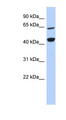 RFC4 Antibody - RFC4 antibody Western blot of 721_B cell lysate. This image was taken for the unconjugated form of this product. Other forms have not been tested.