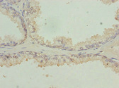 RFPL2 Antibody - Immunohistochemistry of paraffin-embedded human prostate tissue at dilution 1:100
