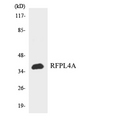 RFPL4A Antibody - Western blot analysis of the lysates from HeLa cells using RFPL4A antibody.