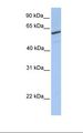 RFT1 Antibody - HepG2 cell lysate. Antibody concentration: 1.0 ug/ml. Gel concentration: 12%.  This image was taken for the unconjugated form of this product. Other forms have not been tested.