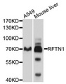 RFTN1 / Raftlin Antibody - Western blot analysis of extracts of various cell lines, using RFTN1 antibody at 1:1000 dilution. The secondary antibody used was an HRP Goat Anti-Rabbit IgG (H+L) at 1:10000 dilution. Lysates were loaded 25ug per lane and 3% nonfat dry milk in TBST was used for blocking. An ECL Kit was used for detection and the exposure time was 5s.