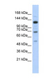 RFX / RFX1 Antibody - RFX1 antibody Western blot of Transfected 293T cell lysate. This image was taken for the unconjugated form of this product. Other forms have not been tested.