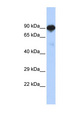 RFX4 Antibody - RFX4 antibody Western blot of Fetal Brain lysate. This image was taken for the unconjugated form of this product. Other forms have not been tested.
