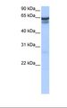 RFX5 Antibody - 721_B cell lysate. Antibody concentration: 2.0 ug/ml. Gel concentration: 12%.  This image was taken for the unconjugated form of this product. Other forms have not been tested.