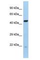 RFX6 Antibody - RFX6 antibody Western Blot of Mouse Liver. Antibody dilution: 1 ug/ml.  This image was taken for the unconjugated form of this product. Other forms have not been tested.