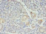 RFX6 Antibody - Immunohistochemistry of paraffin-embedded human pancreatic tissue using antibody at dilution of 1:100.