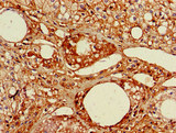RGL2 Antibody - Immunohistochemistry image of paraffin-embedded human adrenal gland tissue at a dilution of 1:100
