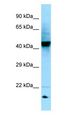 RGP1 Antibody - RGP1 antibody Western Blot of 721_B.  This image was taken for the unconjugated form of this product. Other forms have not been tested.