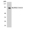 RGPD2+3+4+6+8 Antibody - Western blot analysis of the lysates from Jurkat cells using RGPD2/3/4/6/8 antibody.