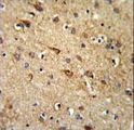 RGR Antibody - RGR Antibody IHC of formalin-fixed and paraffin-embedded brain tissue followed by peroxidase-conjugated secondary antibody and DAB staining.