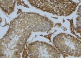 RGS1 Antibody - 1:100 staining mouse testis tissue by IHC-P. The sample was formaldehyde fixed and a heat mediated antigen retrieval step in citrate buffer was performed. The sample was then blocked and incubated with the antibody for 1.5 hours at 22°C. An HRP conjugated goat anti-rabbit antibody was used as the secondary.