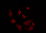 RGS12 Antibody - Staining NIH-3T3 cells by IF/ICC. The samples were fixed with PFA and permeabilized in 0.1% Triton X-100, then blocked in 10% serum for 45 min at 25°C. The primary antibody was diluted at 1:200 and incubated with the sample for 1 hour at 37°C. An Alexa Fluor 594 conjugated goat anti-rabbit IgG (H+L) Ab, diluted at 1/600, was used as the secondary antibody.