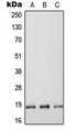 RGS17 / RGSZ2 Antibody - Western blot analysis of RGS17 expression in HEK293T (A); Raw264.7 (B); H9C2 (C) whole cell lysates.