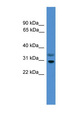 RGS18 Antibody - RGS18 antibody Western blot of HepG2 cell lysate. This image was taken for the unconjugated form of this product. Other forms have not been tested.